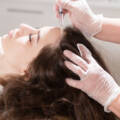 Hair Mesotherapy